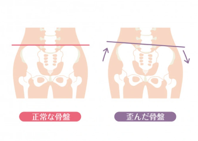 産後の骨盤は歪みやすい|産後の骨盤矯正｜名古屋市昭和区